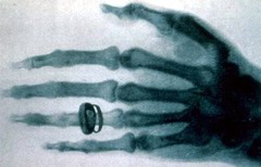 Одна из первых рентгенограмм